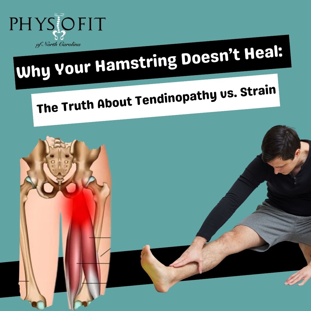 Why Your Hamstring Doesn’t Heal: The Truth About Tendinopathy vs. Strain