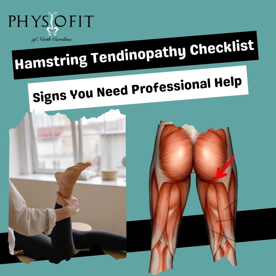 Hamstring Tendinopathy Checklist: Signs You Need Professional Help