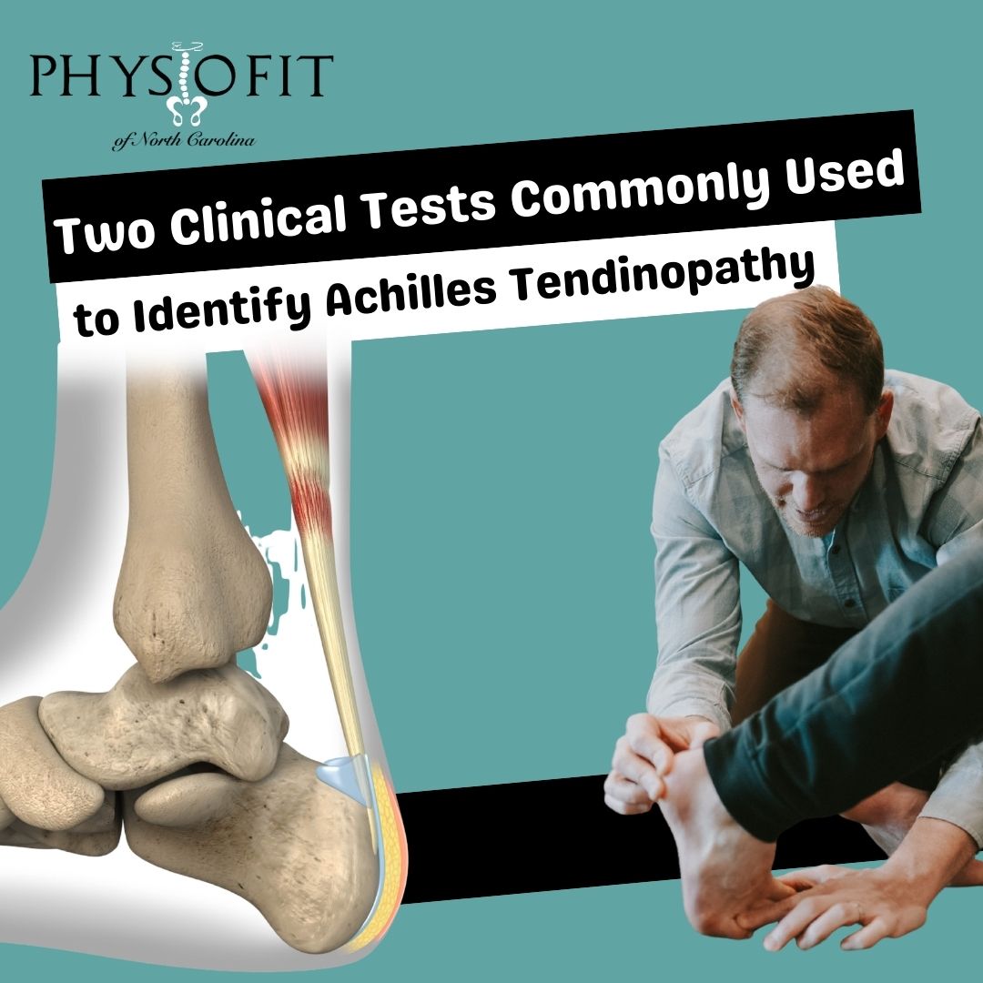 Two Clinical Tests Commonly Used to Identify Achilles Tendinopathy