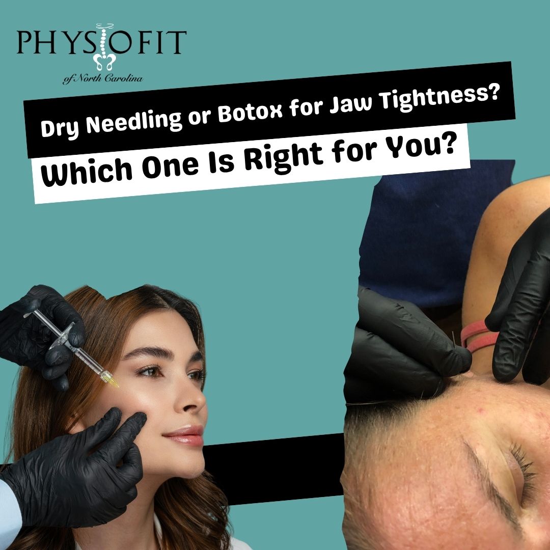 Dry Needling or Botox for Jaw Tightness? Which One is Right For You?