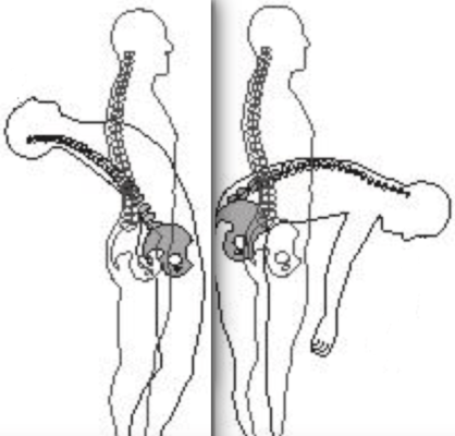 Osteopenia osteoporosis and yoga - Ekhart Yoga