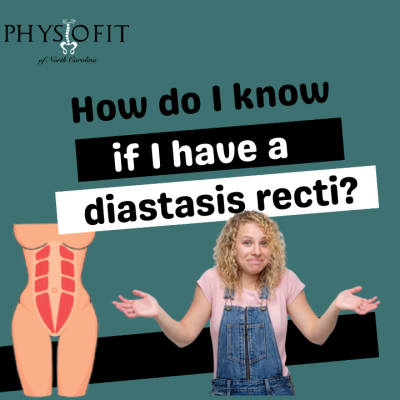 How do I know if I have a Diastasis Recti?