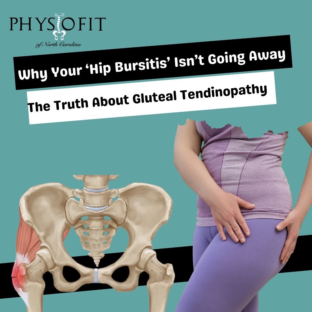 Why your hip bursitis isn't going away