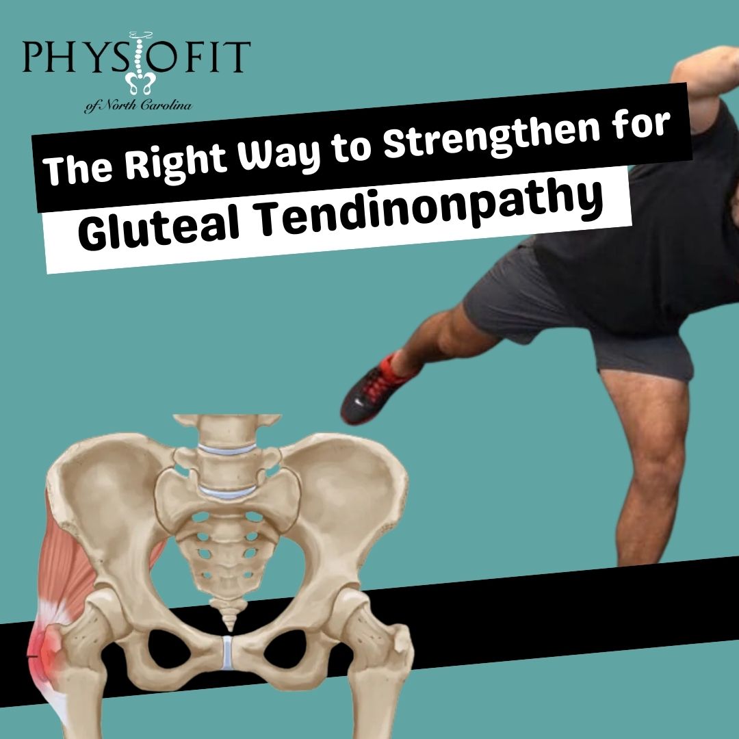 The right way to strengthen for gluteal tendinopathy