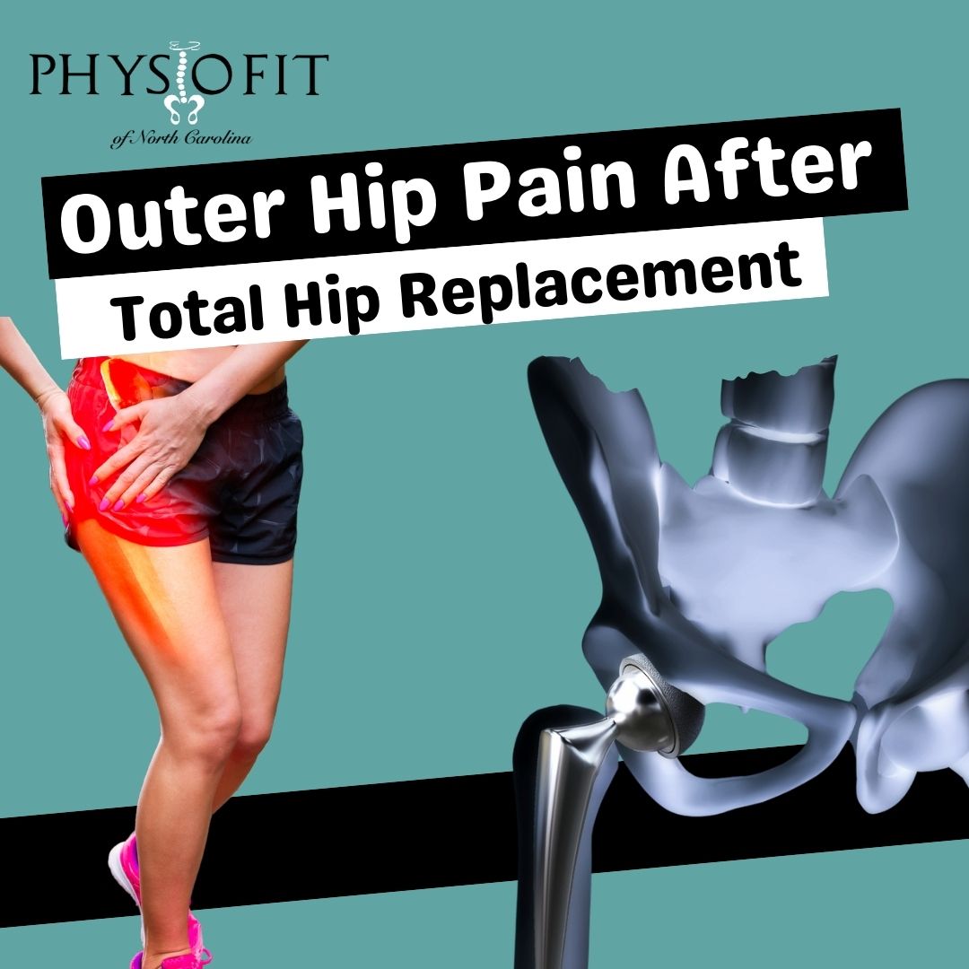 Outer Hip Pain After Total Hip Replacement